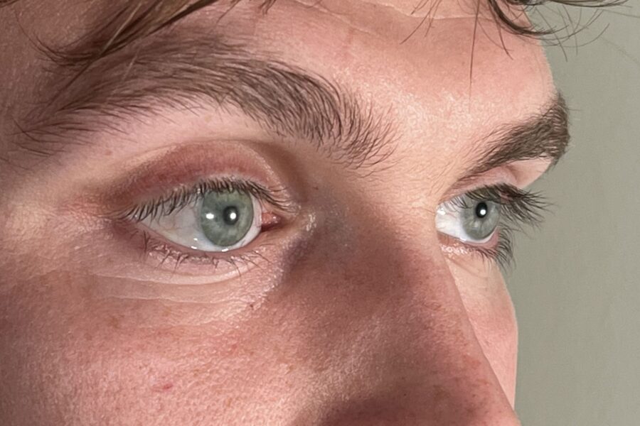 Augenprothesen aus dem 3D-Drucker